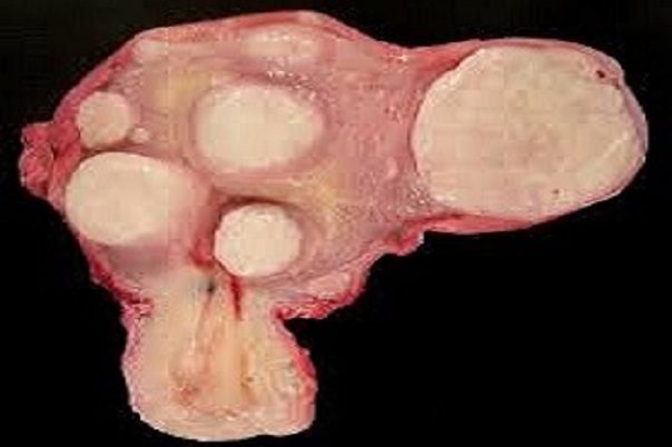 geo inioma mitras | Iatromedia.gr