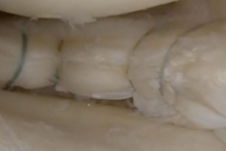 miniskos | Iatromedia.gr