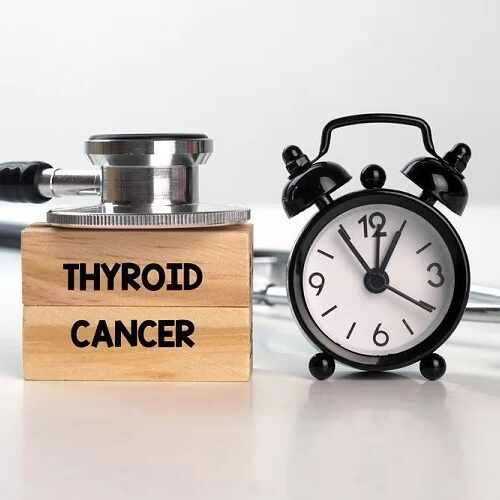 3+1 επιστημονικά στοιχεία για τον καρκίνο του θυρεοειδούς