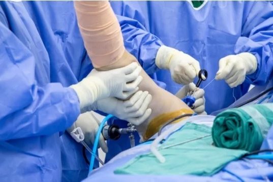 3+1 συμβουλές για ταχύτερη αποκατάσταση μετά την αρθροσκόπηση ώμου 3+1 συμβουλές για ταχύτερη αποκατάσταση μετά την αρθροσκόπηση ώμου