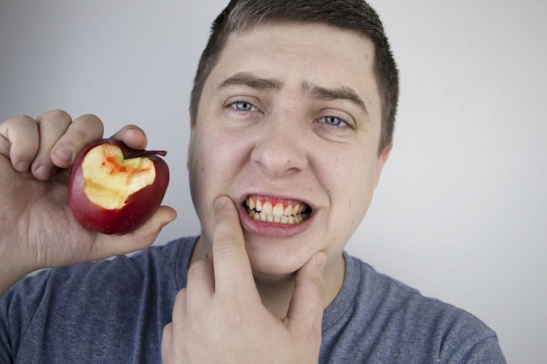 5 βασικοί λόγοι που ματώνουν τα ούλα σας