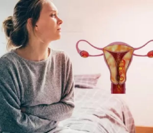 Ενδομητρίωση και καρκίνος