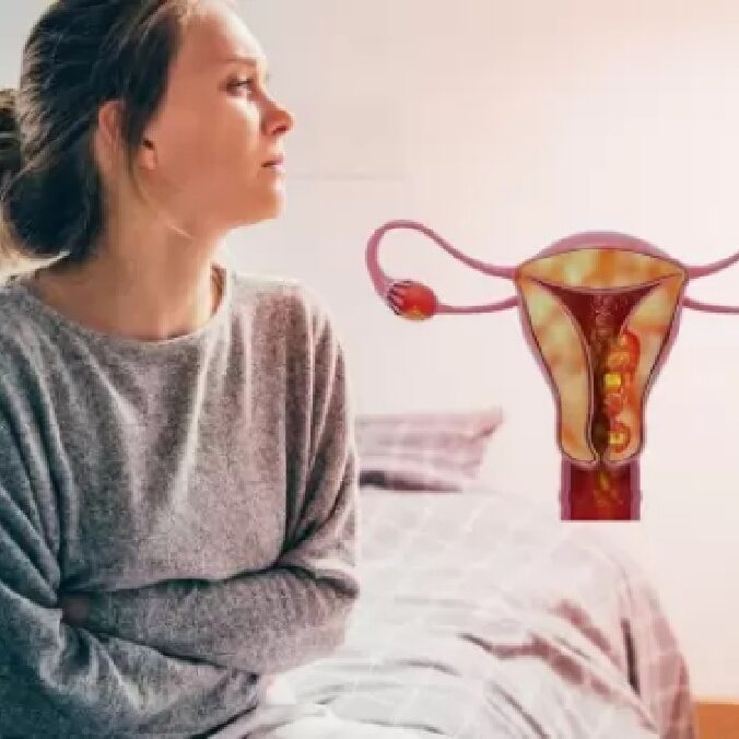 Ενδομητρίωση και καρκίνος