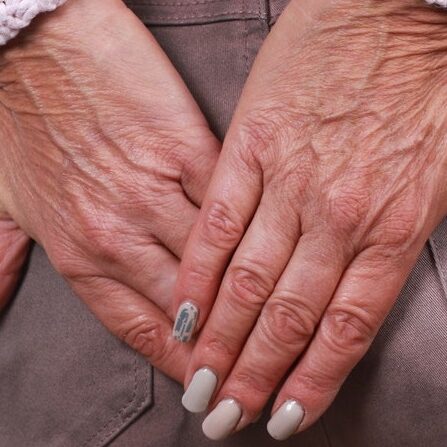 8 αιτίες για τη δημιουργία πρωκτικής ραγάδας