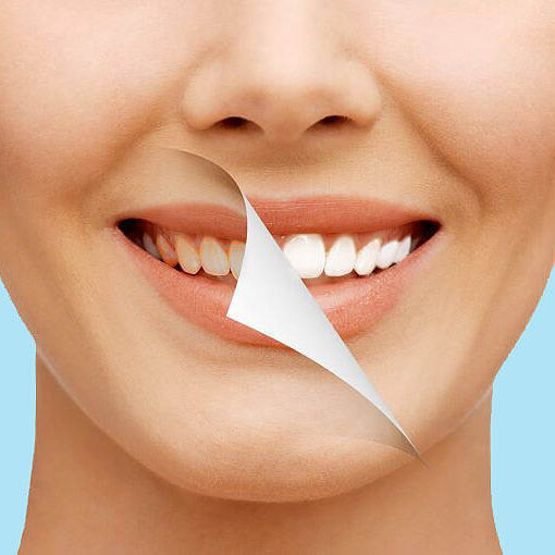 Οι 3 τρόποι λεύκανσης δοντιών για ένα μοναδικό χαμόγελο!