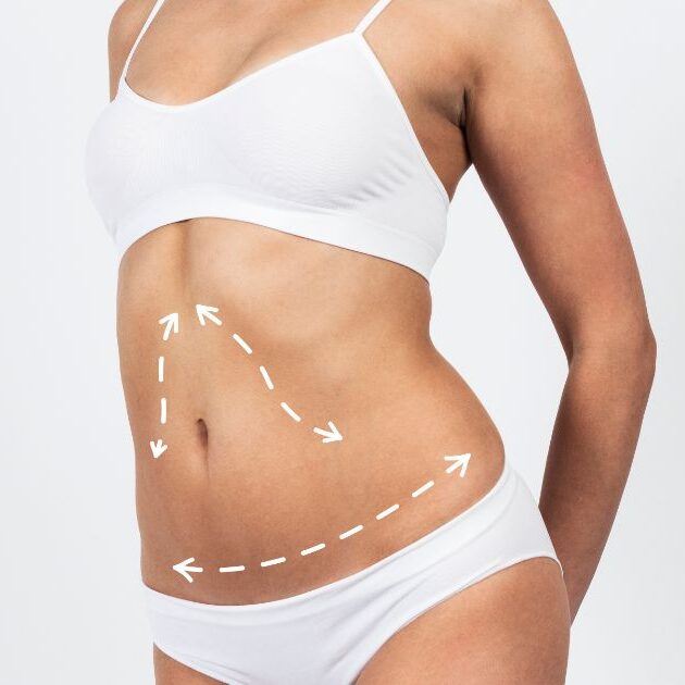 Mommy Makeover: Ολική Αποκατάσταση μετά την Εγκυμοσύνη!