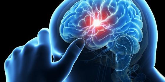 Καρωτιδική Νόσος Καρωτιδική Νόσος