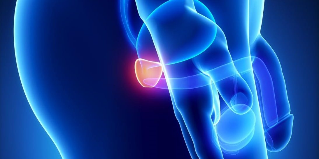 Έρευνα: Καρκίνος του προστάτη και αφροαμερικάνοι