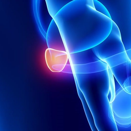 Έρευνα: Καρκίνος του προστάτη και αφροαμερικάνοι