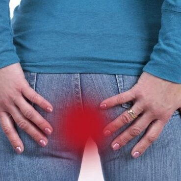 Έρπης του πρωκτού, αιτίες, συμπτώματα, αντιμετώπιση