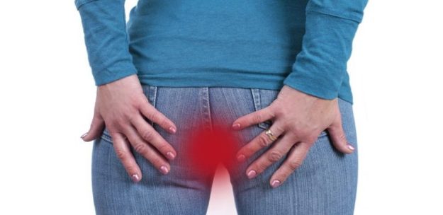 Έρπης του πρωκτού, αιτίες, συμπτώματα, αντιμετώπιση