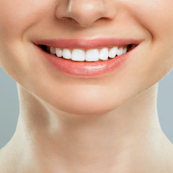 Όψη ρητίνης ή πορσελάνης