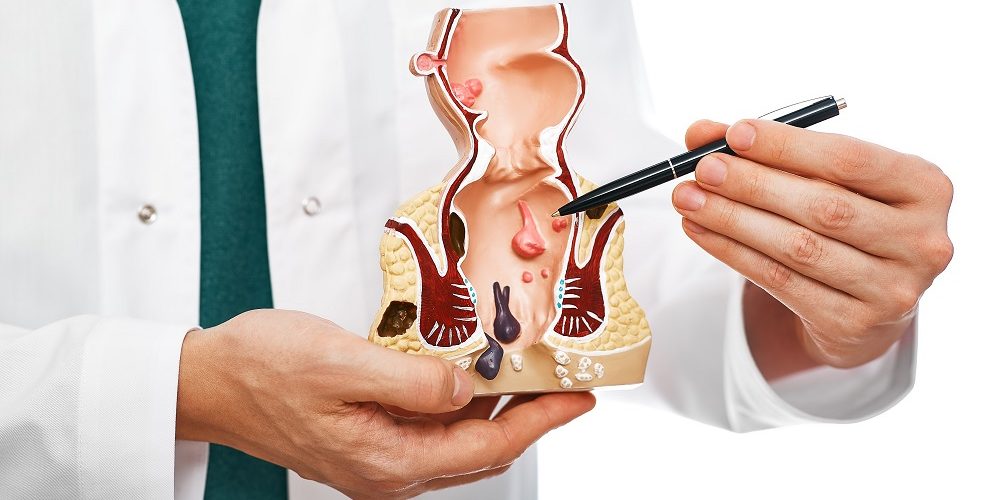 Αίμα στα κόπρανα Αίμα στα κόπρανα