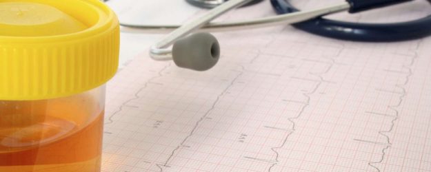 Αίμα στα ούρα