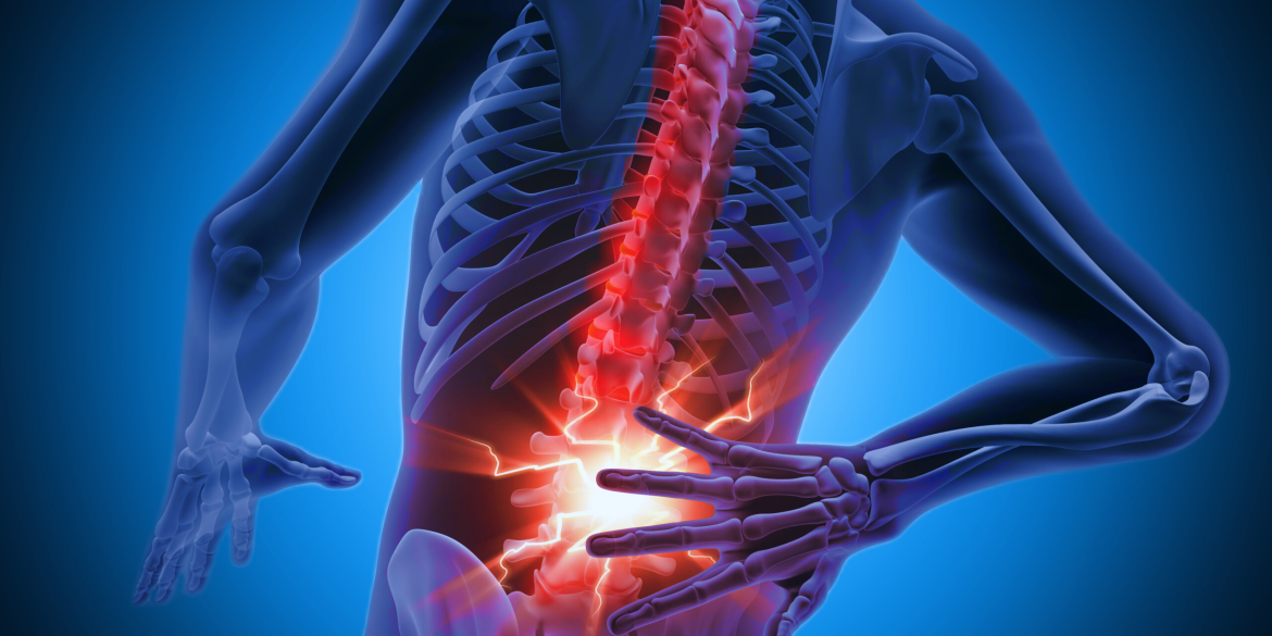 Αγκυλοποιητική Σπονδυλίτιδα: Συμπτώματα & Θεραπεία Αγκυλοποιητική Σπονδυλίτιδα: Συμπτώματα & Θεραπεία