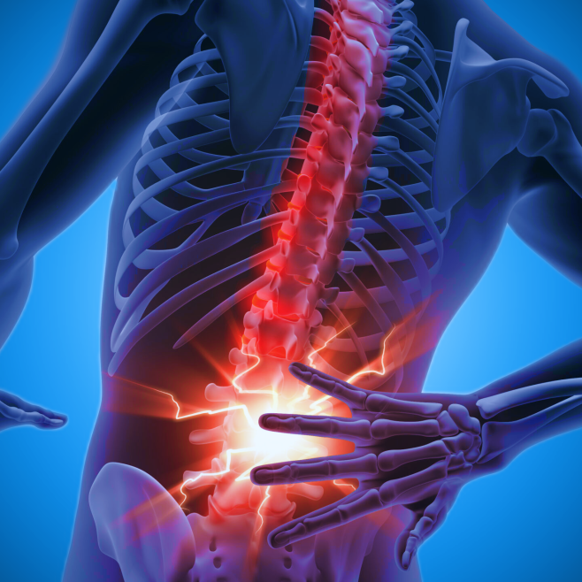 Αγκυλοποιητική Σπονδυλίτιδα: Συμπτώματα & Θεραπεία