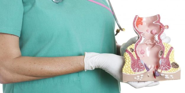 Αιμορροΐδες, αλκοόλ και καπνός. Υπάρχει σχέση μεταξύ τους;