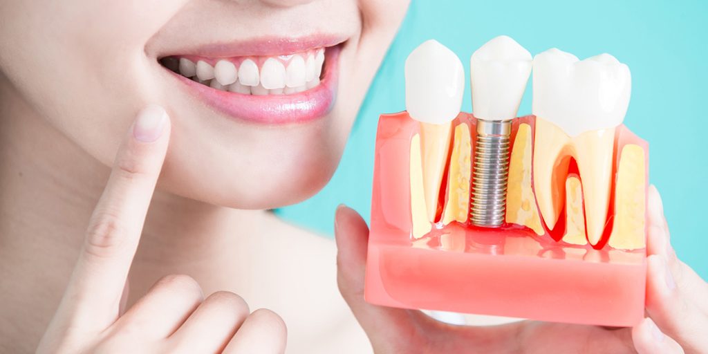 Αισθητική Οδοντιατρική