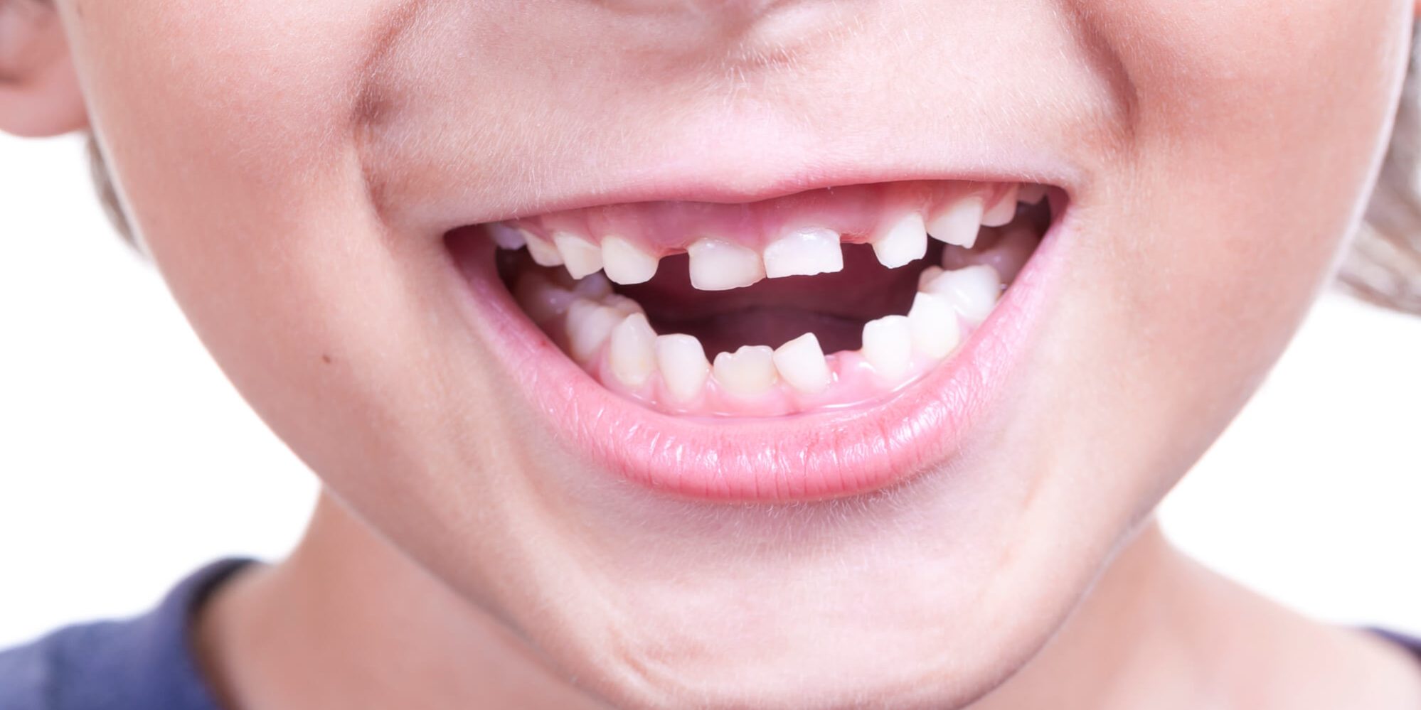 Αναπνευστικές δυσλειτουργίες και ορθοδοντικά προβλήματα