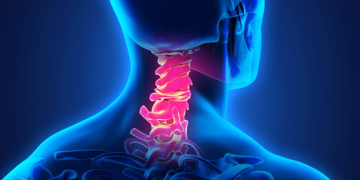 Αντικατάσταση Αυχενικού Δίσκου και Οφέλη