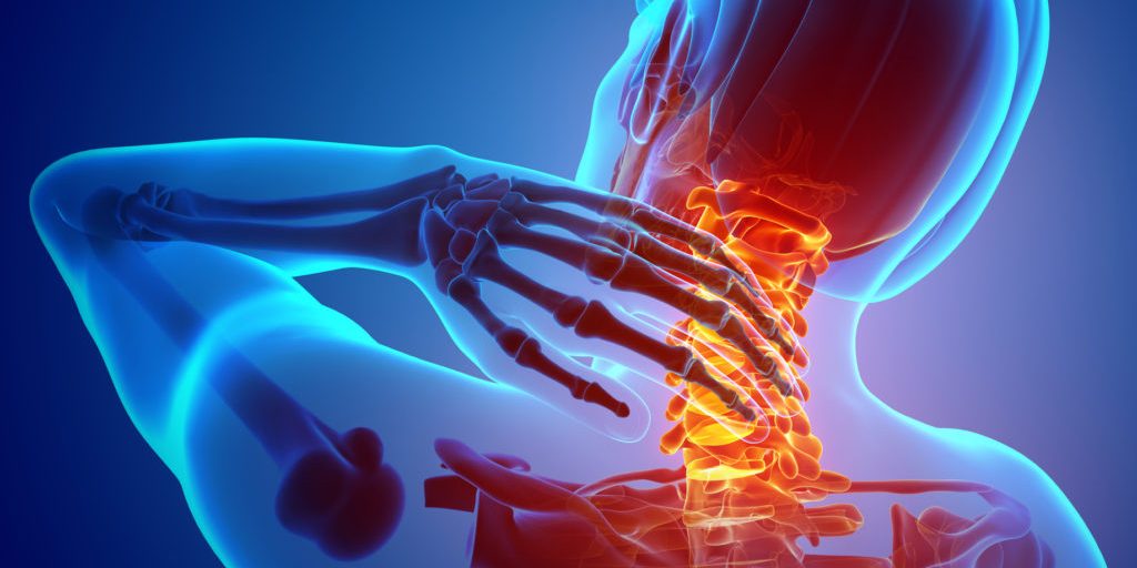 Αρθρίτιδα Αυχένα