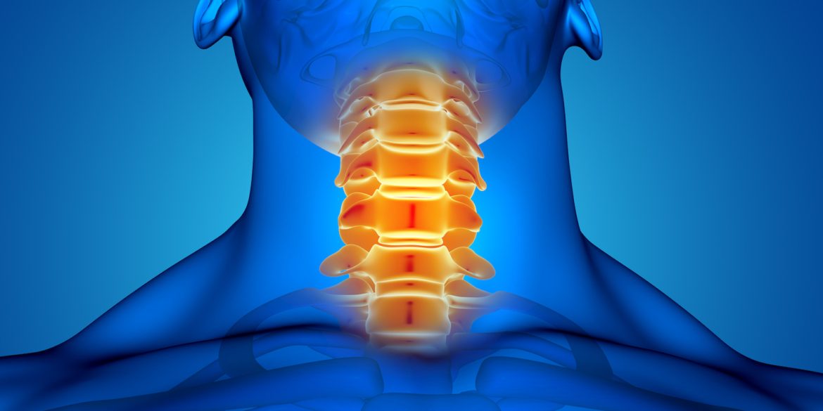 Αυχενική μυελοπάθεια: Αίτια, συμπτώματα & θεραπεία Αυχενική μυελοπάθεια: Αίτια, συμπτώματα & θεραπεία