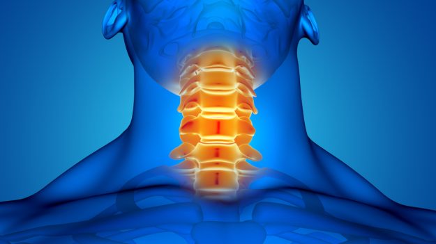 Αυχενική μυελοπάθεια: Αίτια, συμπτώματα & θεραπεία