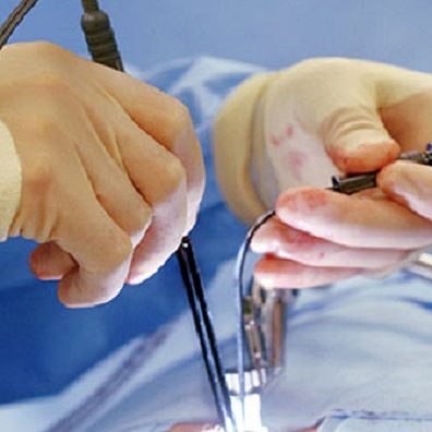 Γυναικολογική λαπαροσκόπηση