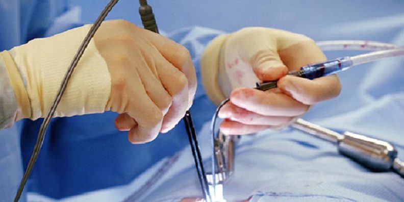 Γυναικολογική λαπαροσκόπηση