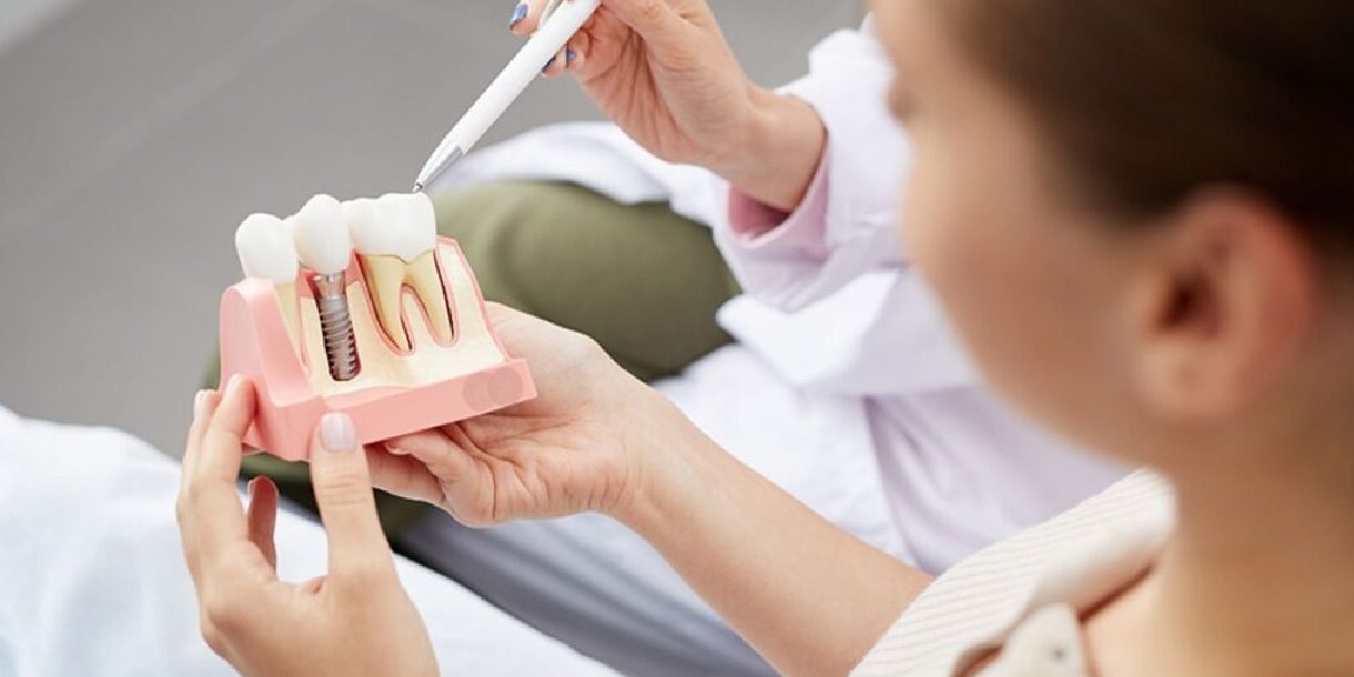 Διατήρηση οστού