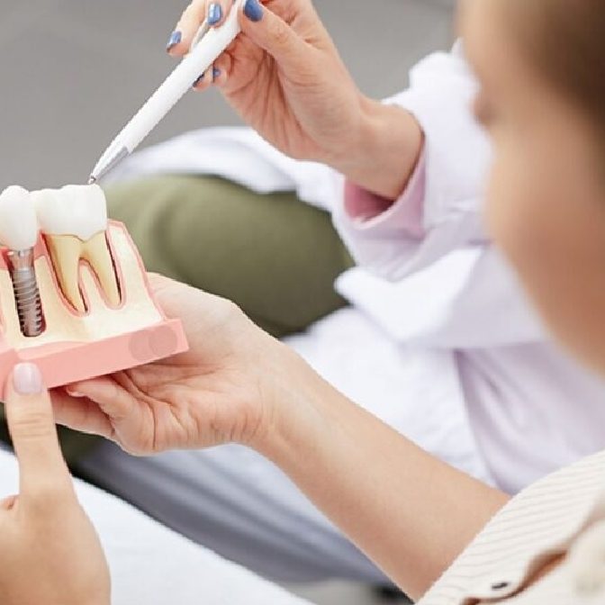 Διατήρηση οστού