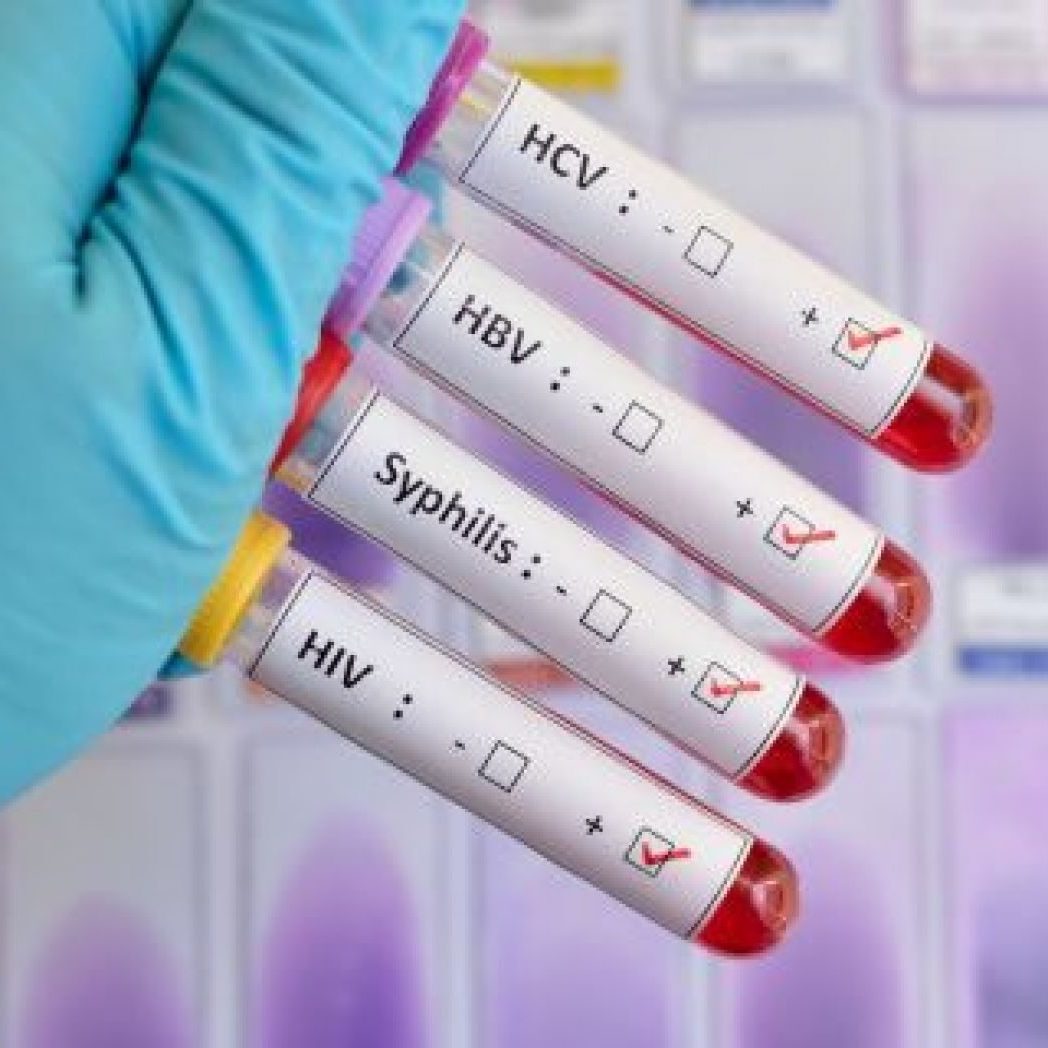 Είναι η φαγούρα στον πρωκτό ένα σύμπτωμα μιας ΣΜΑ;