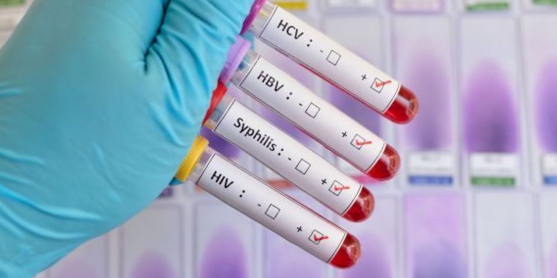 Είναι η φαγούρα στον πρωκτό ένα σύμπτωμα μιας ΣΜΑ; Είναι η φαγούρα στον πρωκτό ένα σύμπτωμα μιας ΣΜΑ;