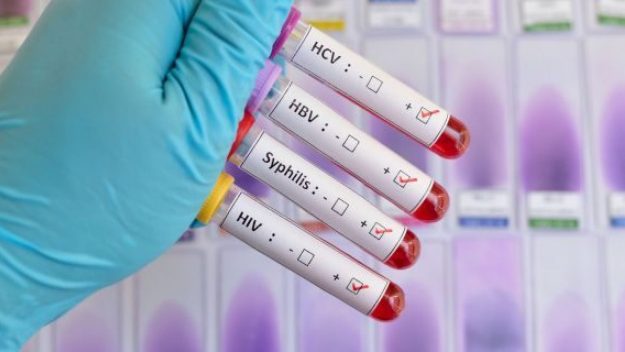 Είναι η φαγούρα στον πρωκτό ένα σύμπτωμα μιας ΣΜΑ;