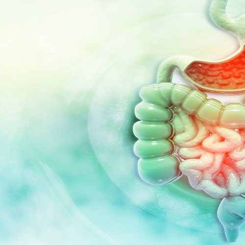 Εκκολπωματίτιδα