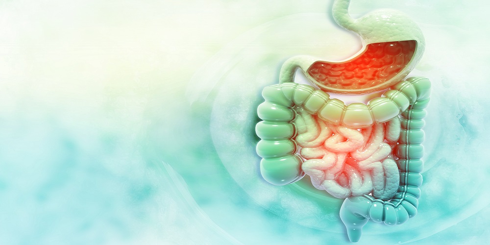 Εκκολπωματίτιδα