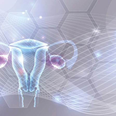 Ενδομητρίωση: Συμπτώματα κι Αντιμετώπιση