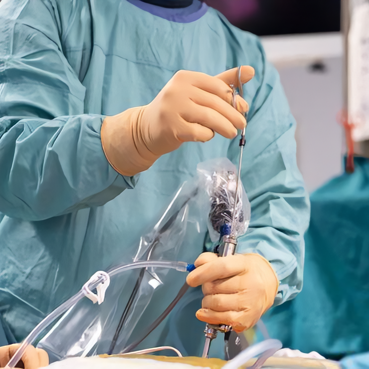 Ενδοσκοπική Επέμβαση