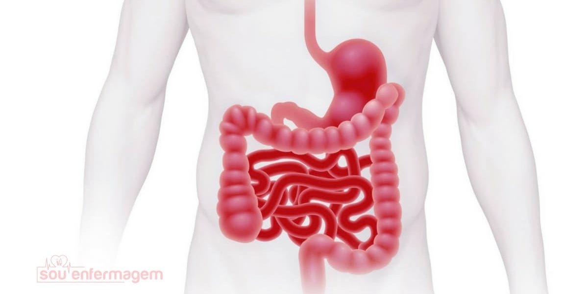 Εντερική ανεπάρκεια Εντερική ανεπάρκεια