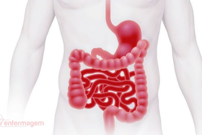 Εντερική ανεπάρκεια