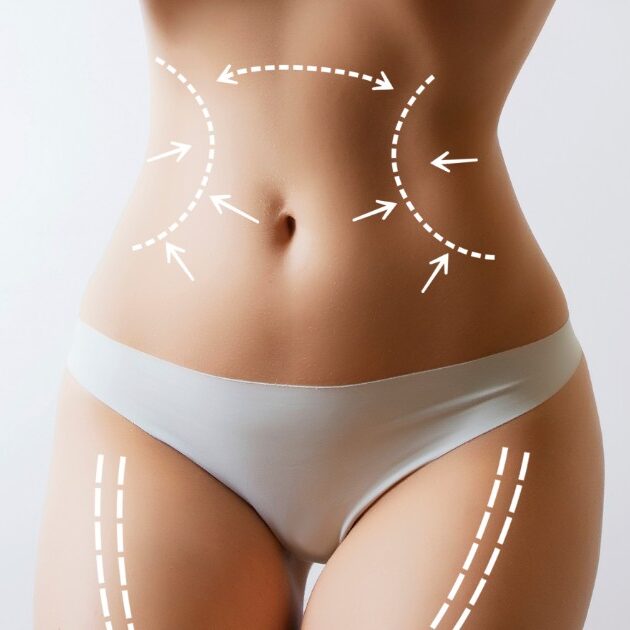 Επίπεδη Κοιλιά: Θεραπείες για Γυναίκες & Άνδρες