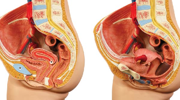 Επισκόπηση του ορθού και του πρωκτού