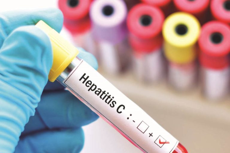 Ηπατίτιδα C στις γυναίκες