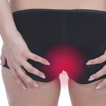 Θεραπεία πρωκτικών ραγάδων