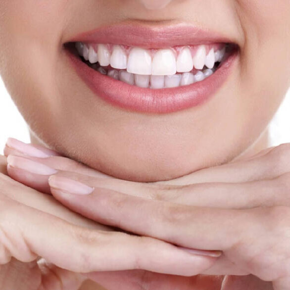 Θεραπείες Αισθητικής Οδοντιατρικής Ποιες είναι οι πιο δημοφιλείς;