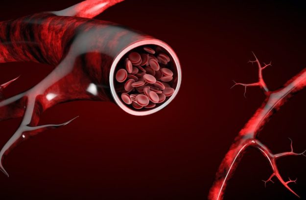 Θρόμβωση Φλεβών Στο Πόδι: Παράγοντες Κινδύνου, Συμπτώματα Και Θεραπεία