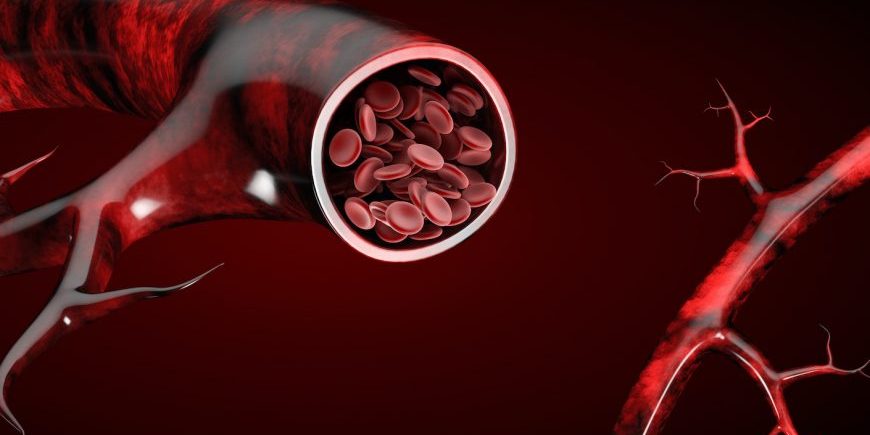 Θρόμβωση Φλεβών Στο Πόδι: Παράγοντες Κινδύνου, Συμπτώματα Και Θεραπεία