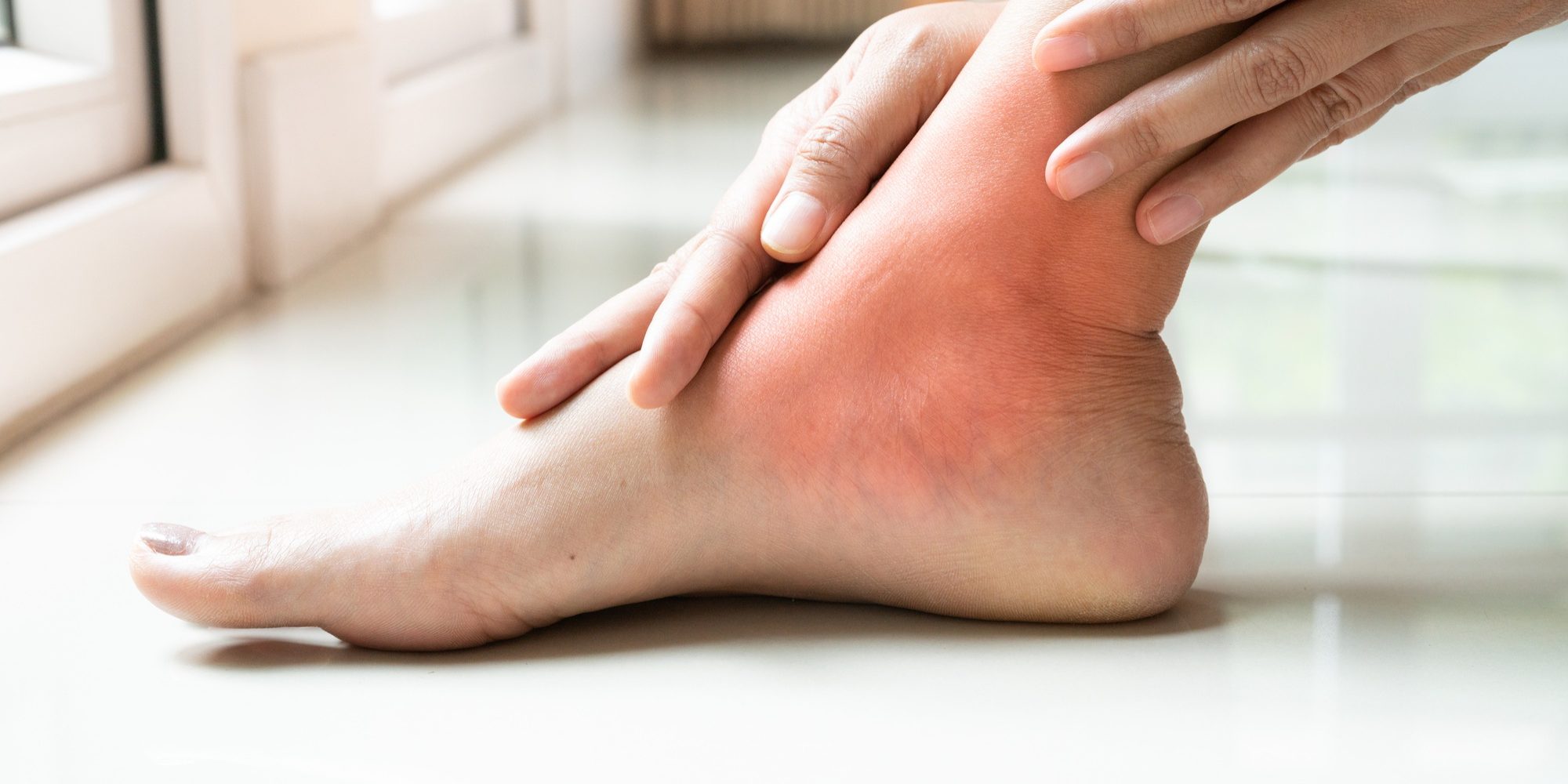 Κάταγμα Αστραγάλου Κατηγοριοποίηση, Διάγνωση & Θεραπεία