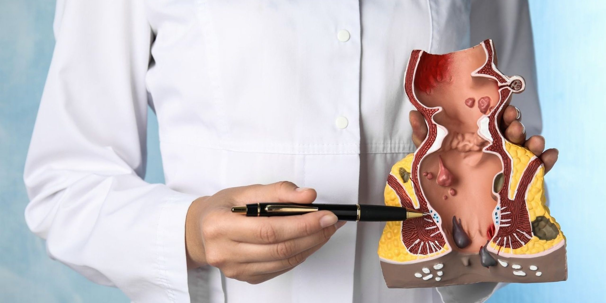 Καρκίνος Πρωκτού: Αίτια και Συμπτώματα