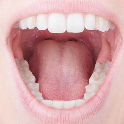 Καρκίνος της στοματικής κοιλότητας: Όσα πρέπει να γνωρίζετε